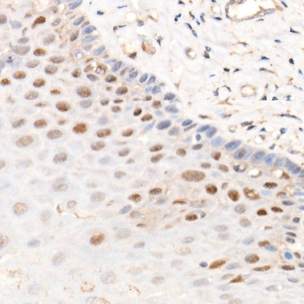 CDK4 Rabbit Monoclonal Antibody - Image 3