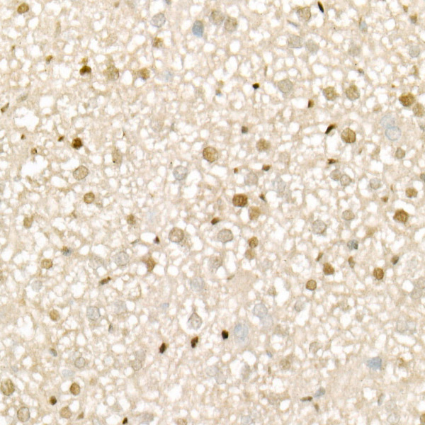 CDK4 Rabbit Monoclonal Antibody - Image 4