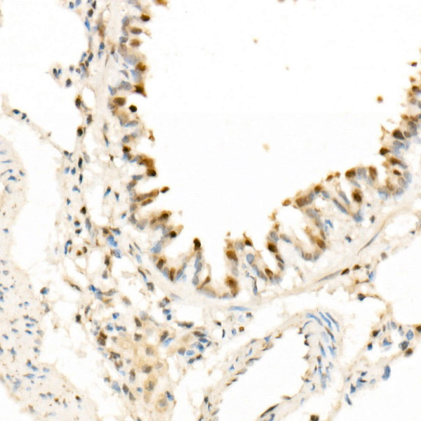 CDK4 Rabbit Monoclonal Antibody - Image 5