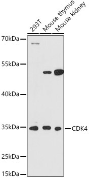 CDK4 Rabbit Polyclonal Antibody