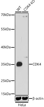 CDK4 Rabbit Polyclonal Antibody - Image 2