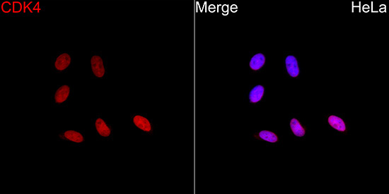 CDK4 Rabbit Polyclonal Antibody - Image 3