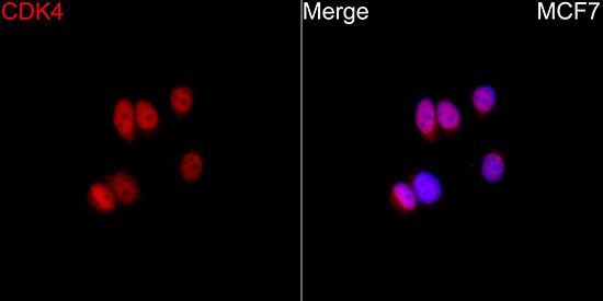 CDK4 Rabbit Polyclonal Antibody - Image 4