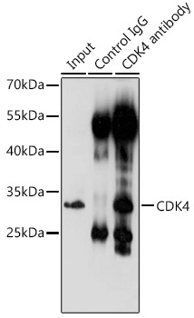 CDK4 Rabbit Polyclonal Antibody - Image 5