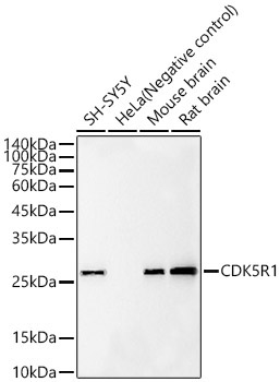 CDK5R1 Rabbit Monoclonal Antibody