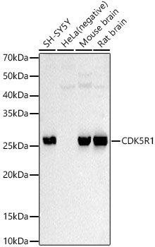 CDK5R1 Rabbit Polyclonal Antibody