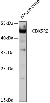CDK5R2 Rabbit Polyclonal Antibody