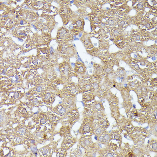 CDK5RAP1 Rabbit Polyclonal Antibody - Image 2