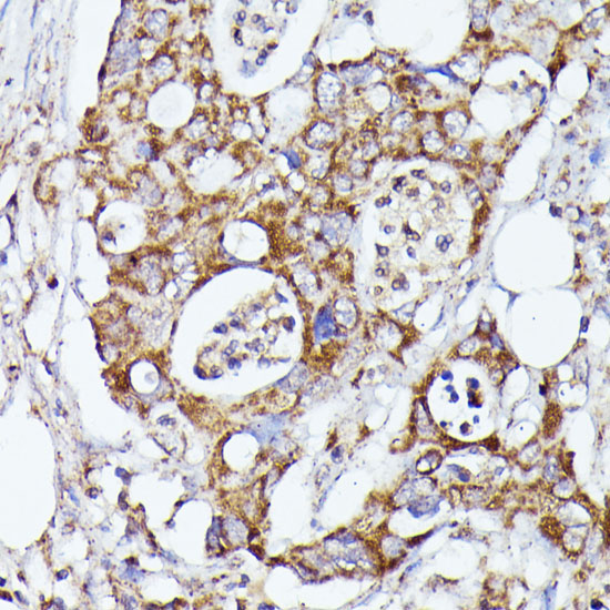 CDK5RAP1 Rabbit Polyclonal Antibody - Image 3