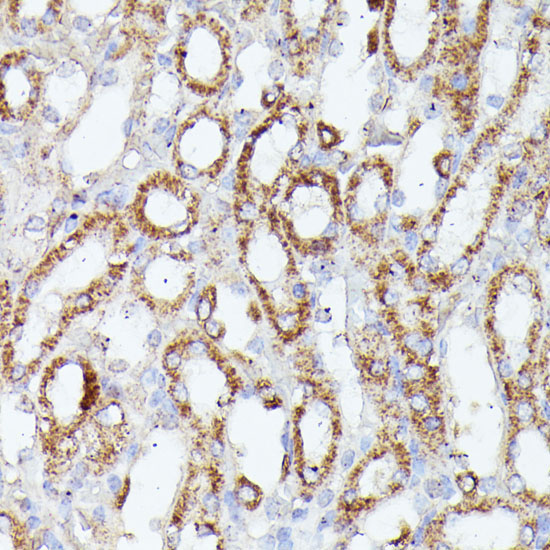 CDK5RAP1 Rabbit Polyclonal Antibody - Image 4