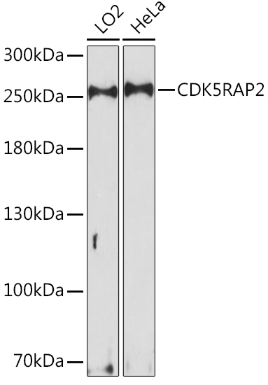 CDK5RAP2 Rabbit Polyclonal Antibody