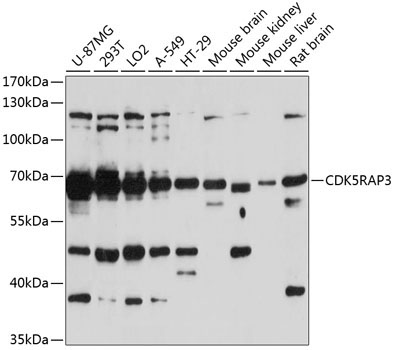 CDK5RAP3 Rabbit Polyclonal Antibody