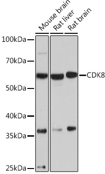 CDK8 Rabbit Monoclonal Antibody
