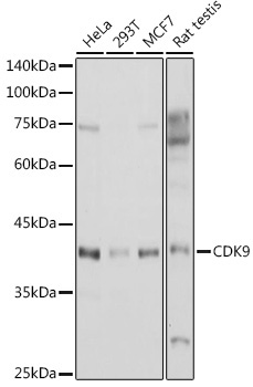 CDK9 Rabbit Polyclonal Antibody
