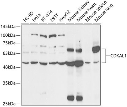 CDKAL1 Rabbit Polyclonal Antibody