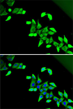 CDKAL1 Rabbit Polyclonal Antibody - Image 2