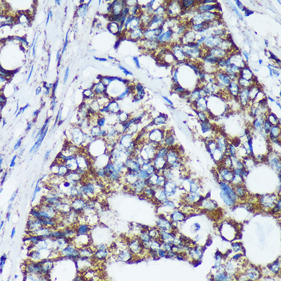 CDKL3 Rabbit Polyclonal Antibody - Image 2