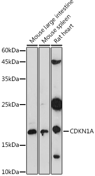 CDKN1A Rabbit Polyclonal Antibody