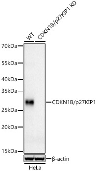 CDKN1B/p27KIP1 Rabbit Monoclonal Antibody