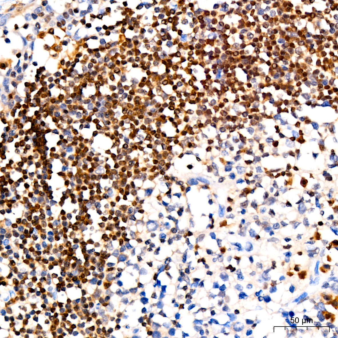 CDKN1B/p27KIP1 Rabbit Monoclonal Antibody - Image 2