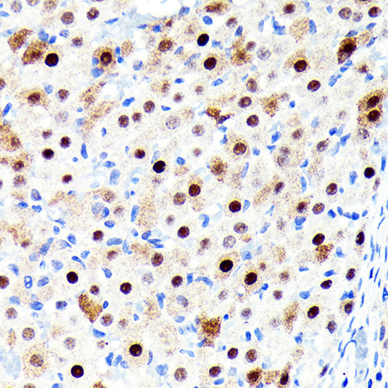 CDKN1B/p27KIP1 Rabbit Monoclonal Antibody - Image 3