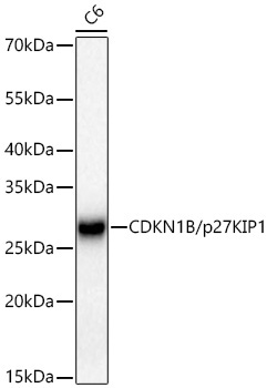 CDKN1B/p27KIP1 Rabbit Monoclonal Antibody - Image 4