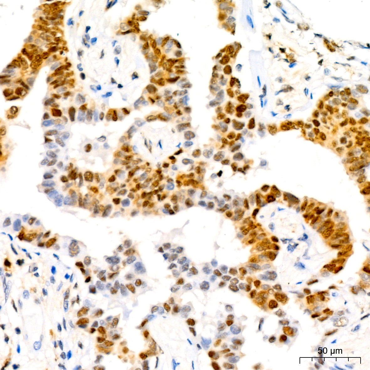 CDKN1B/p27KIP1 Rabbit Monoclonal Antibody - Image 7