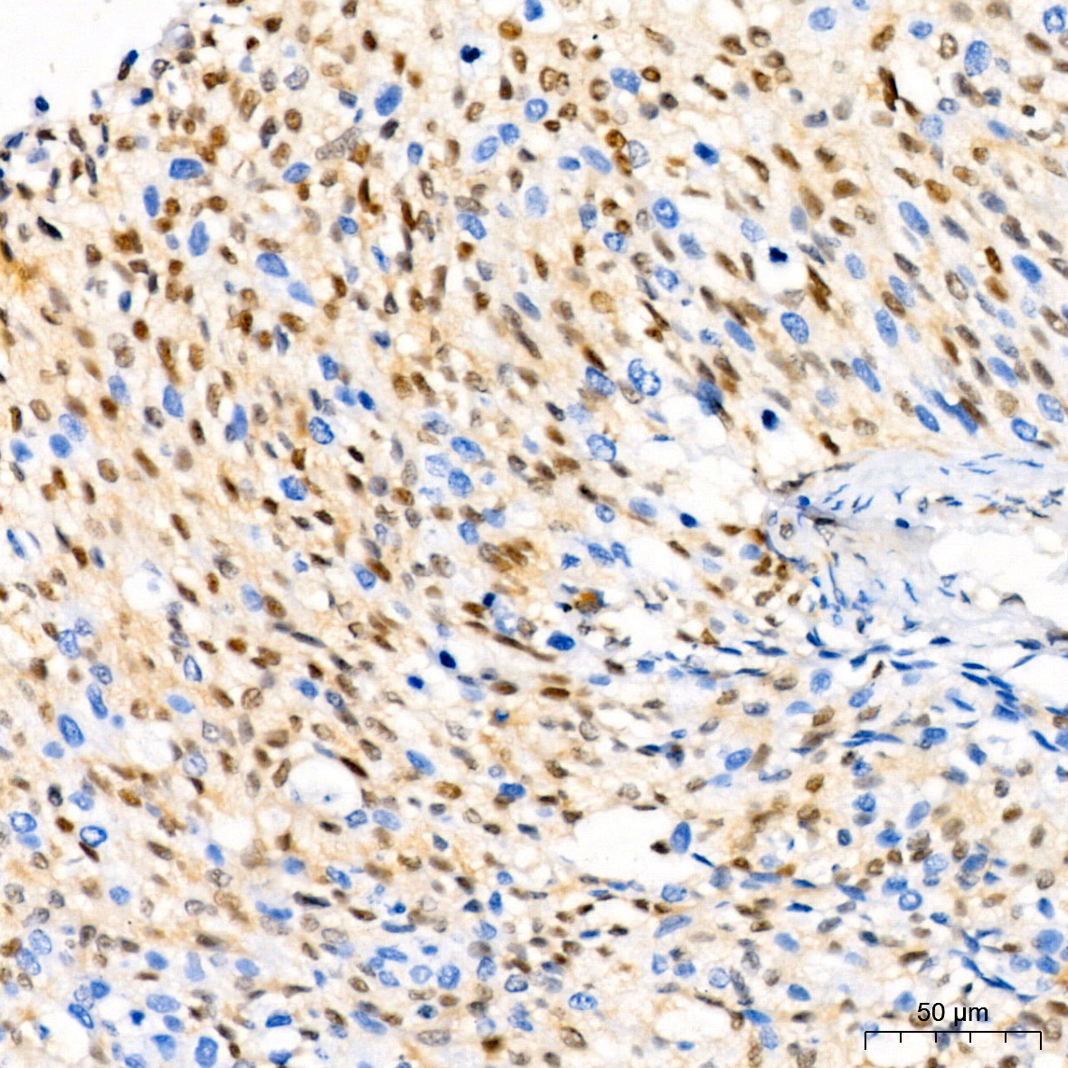 CDKN1B/p27KIP1 Rabbit Monoclonal Antibody - Image 8
