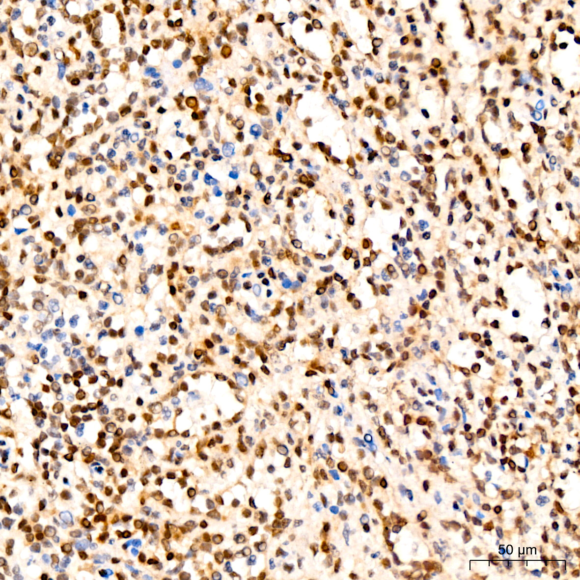 CDKN1B/p27KIP1 Rabbit Monoclonal Antibody - Image 10