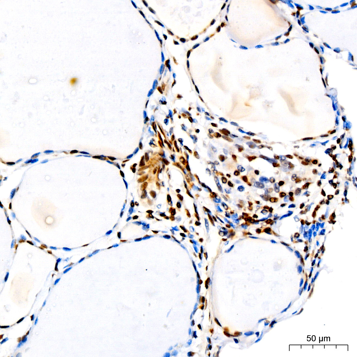 CDKN1B/p27KIP1 Rabbit Monoclonal Antibody - Image 11