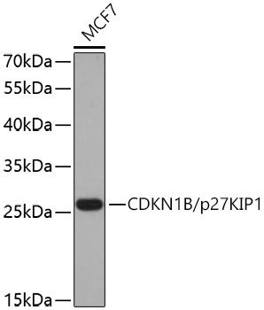 CDKN1B/p27KIP1 Rabbit Polyclonal Antibody