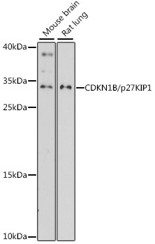 CDKN1B/p27KIP1 Rabbit Polyclonal Antibody