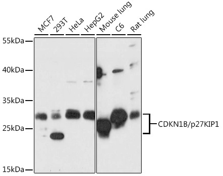 CDKN1B/p27KIP1 Rabbit Polyclonal Antibody