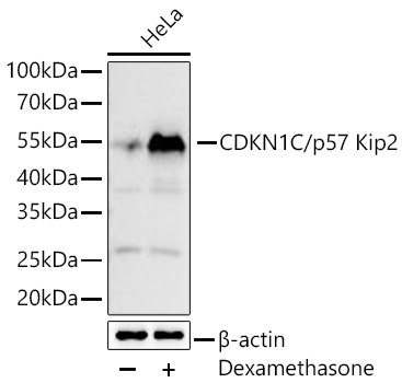 CDKN1C/p57 Kip2 Rabbit Monoclonal Antibody