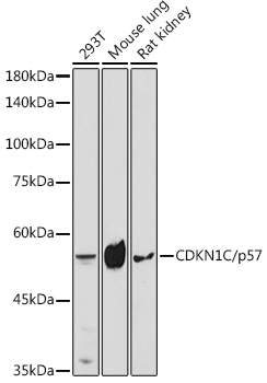 CDKN1C/p57 Kip2 Rabbit Polyclonal Antibody