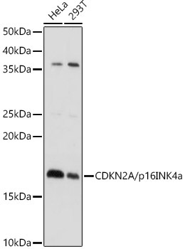 CDKN2A/p16INK4a Rabbit Polyclonal Antibody