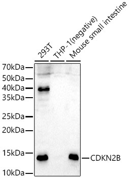 CDKN2B Rabbit Polyclonal Antibody