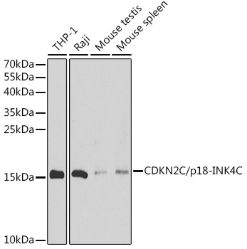 CDKN2C/p18-INK4C Rabbit Polyclonal Antibody