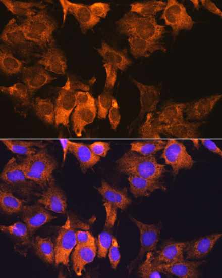 CDV3 Rabbit Polyclonal Antibody - Image 2