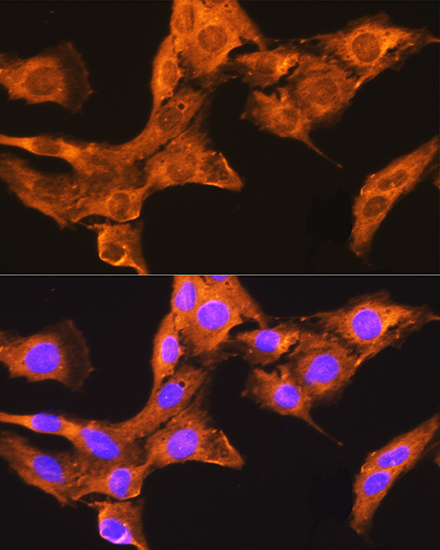 CDV3 Rabbit Polyclonal Antibody - Image 3