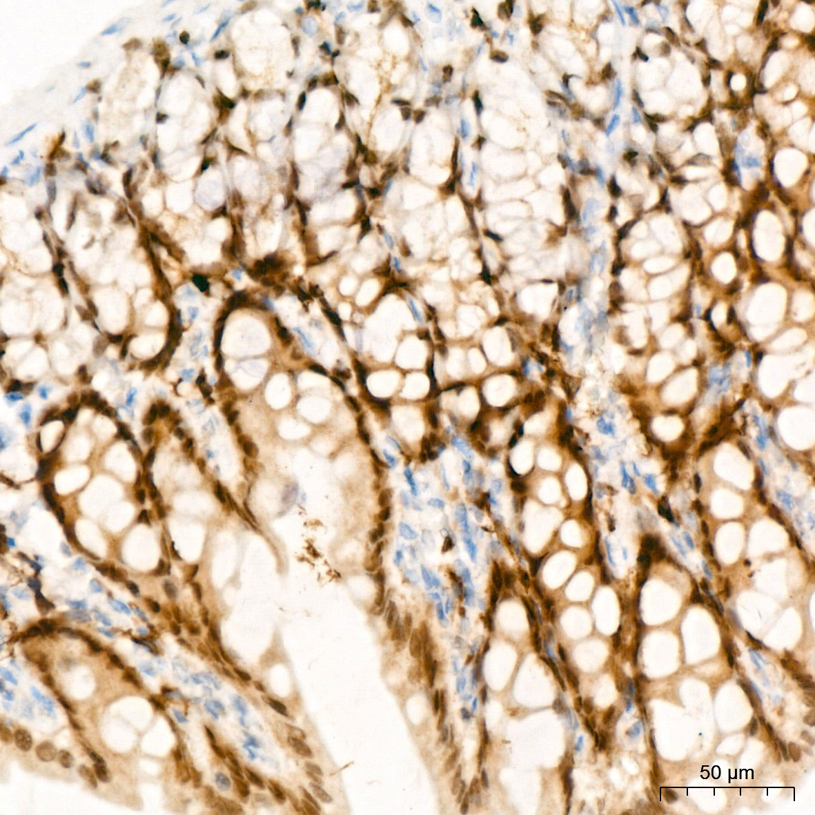 CDX2 Rabbit Polyclonal Antibody