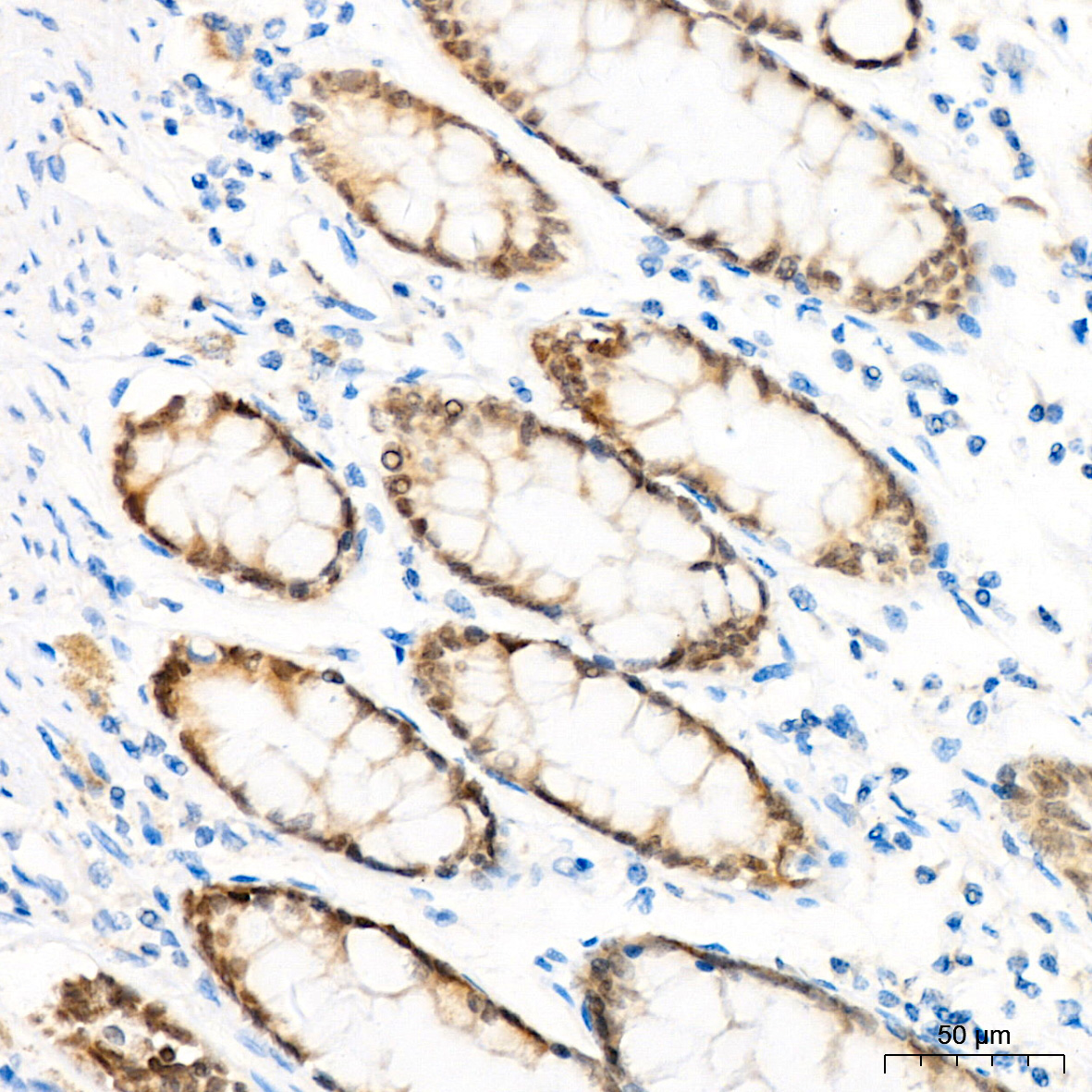 CDX2 Rabbit Polyclonal Antibody - Image 2