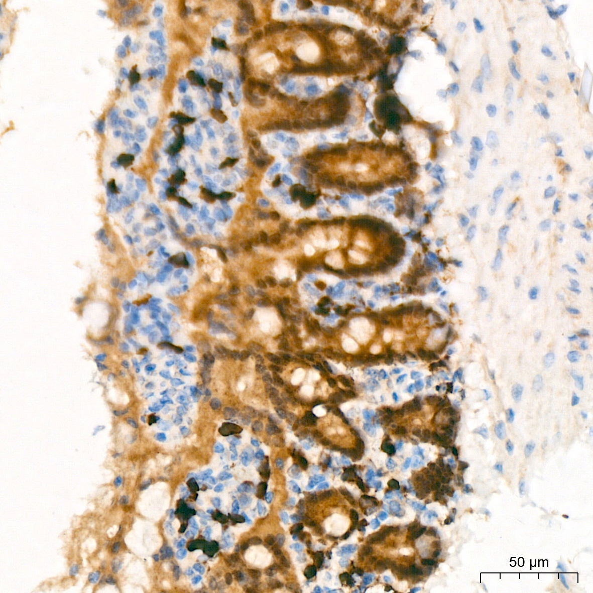 CDX2 Rabbit Polyclonal Antibody - Image 3