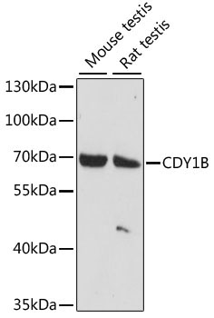 CDY1B Rabbit Polyclonal Antibody