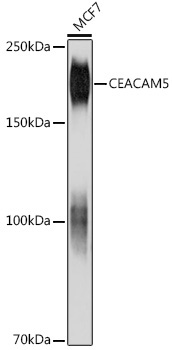 CEACAM5 Mouse Monoclonal Antibody