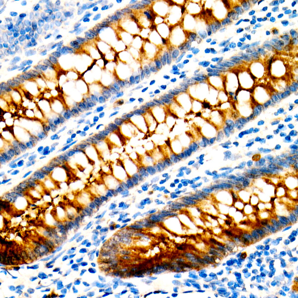 CEACAM5 Mouse Monoclonal Antibody - Image 2