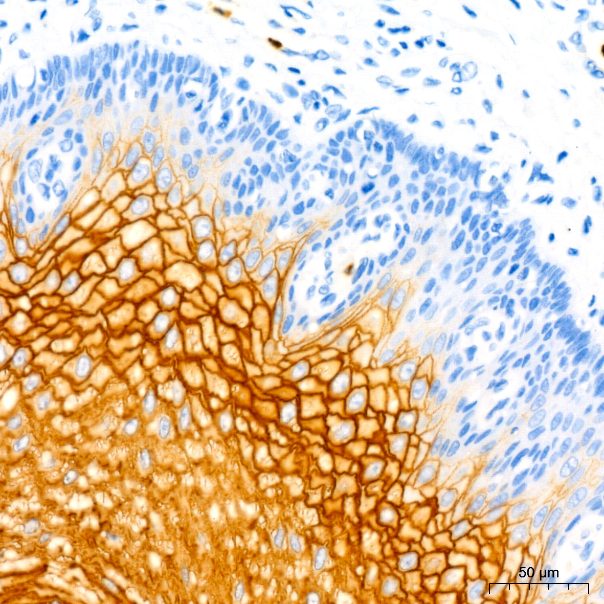CEACAM5 Mouse Monoclonal Antibody - Image 3