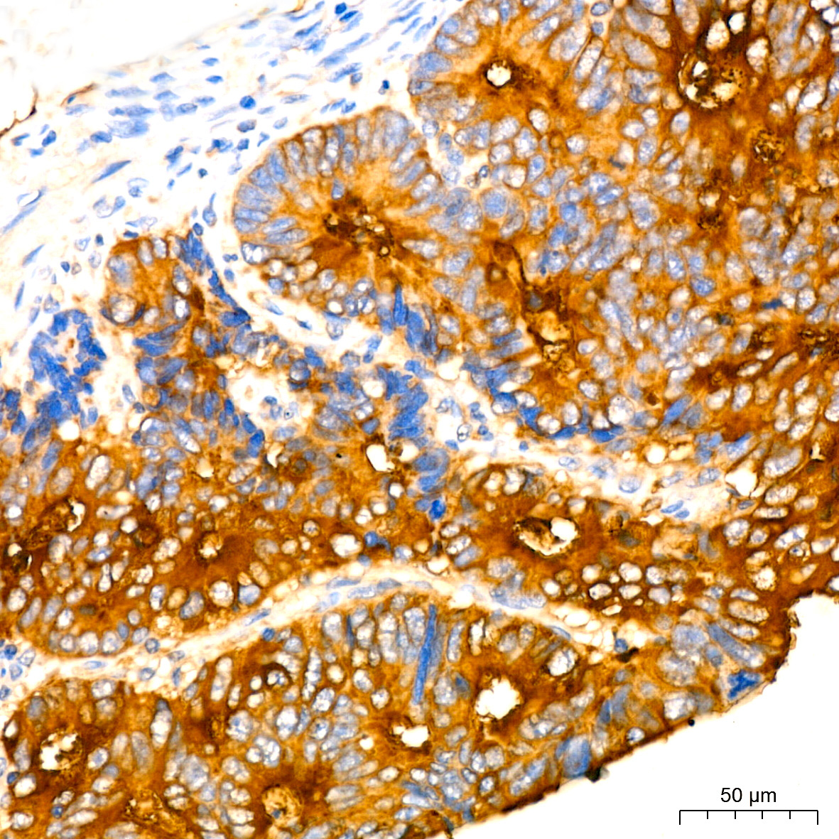 CEACAM5 Mouse Monoclonal Antibody - Image 4