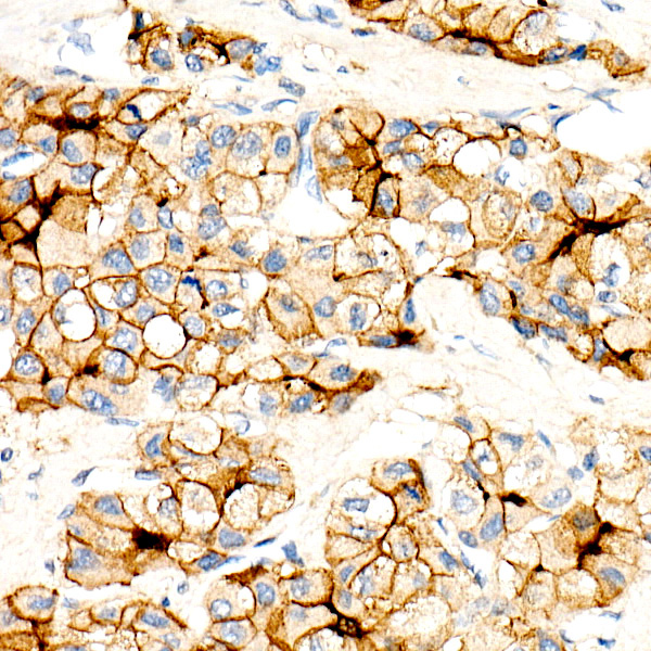 CEACAM5 Mouse Monoclonal Antibody - Image 5