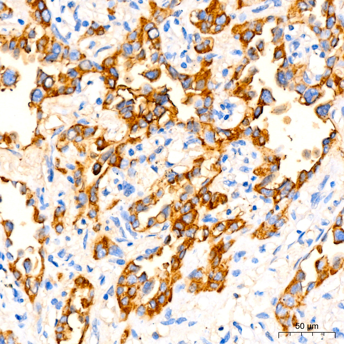 CEACAM5 Mouse Monoclonal Antibody - Image 6